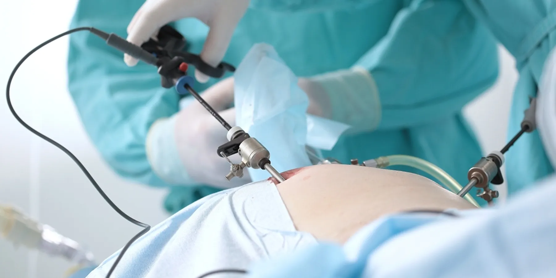 Laparoscopic Surgery Team