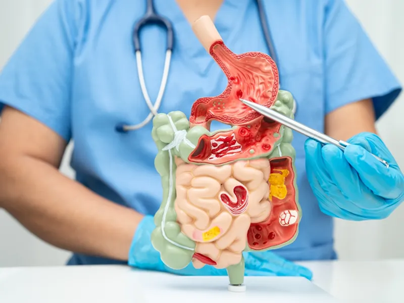 Medical Gastroenterology