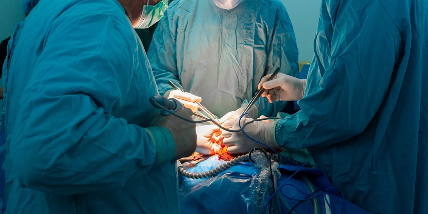 Surgical Oncology OT